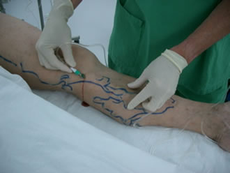 Hochrheinchirurgie Dr. med F. Hauss