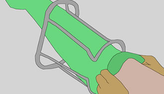 Hochrheinchirurgie Dr. med F. Hauss