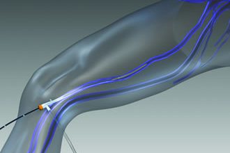 Hochrheinchirurgie Dr. med F. Hauss