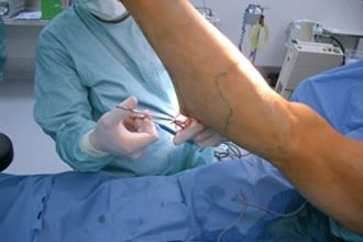 Hochrheinchirurgie Dr. med F. Hauss