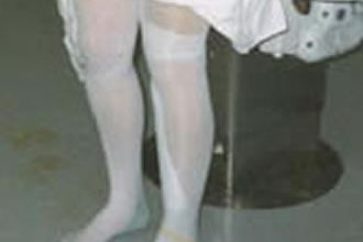 Hochrheinchirurgie Dr. med F. Hauss