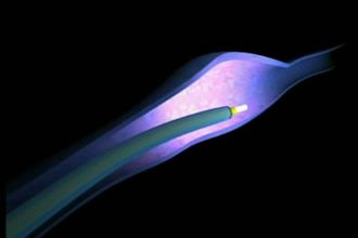 Hochrheinchirurgie Dr. med F. Hauss