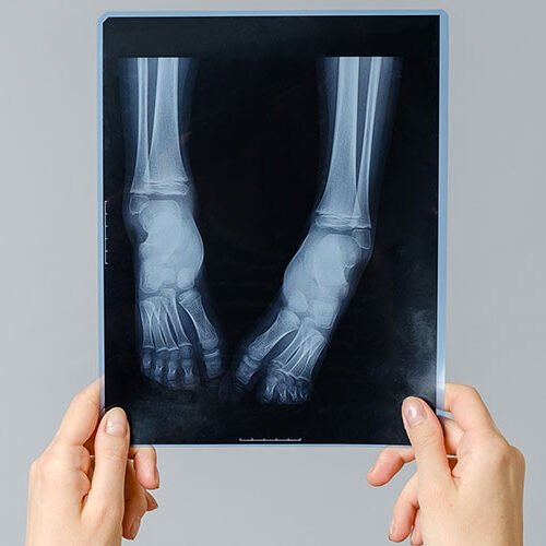 Hochrheinchirurgie Dr. med F. Hauss